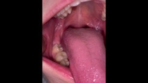 Uvula Show. very Close View. Gagging